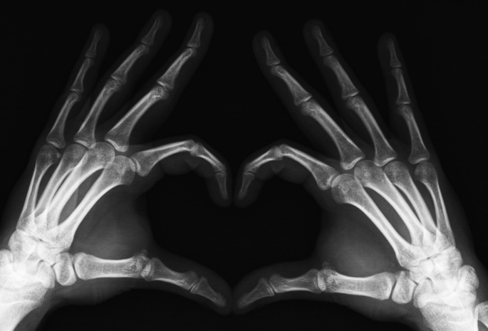 пальцы, Рентген, конечности, руки