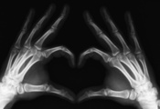 пальцы, Рентген, конечности, руки